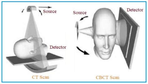 ct vs cbct|What Is the Difference Between a CT Scanner & a .